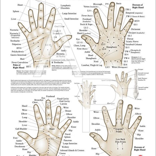 Chinese & Korean Hand Therapy Hand Acupuncture Poster 18" X 24"