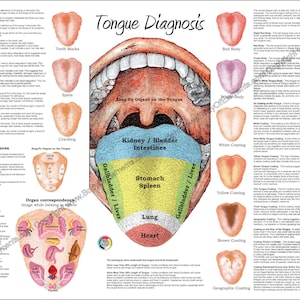 Chinese tongdiagnose poster 24 x 36 inch traditionele Chinese geneeskunde acupunctuur ayurvedische kaart kaartpapier of gelamineerd