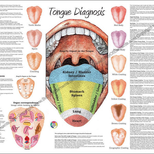 Chinese Tongue Diagnosis Poster 24" X 36" Traditional Chinese Medicine Acupuncture Ayurvedic Map Chart Paper or Laminated