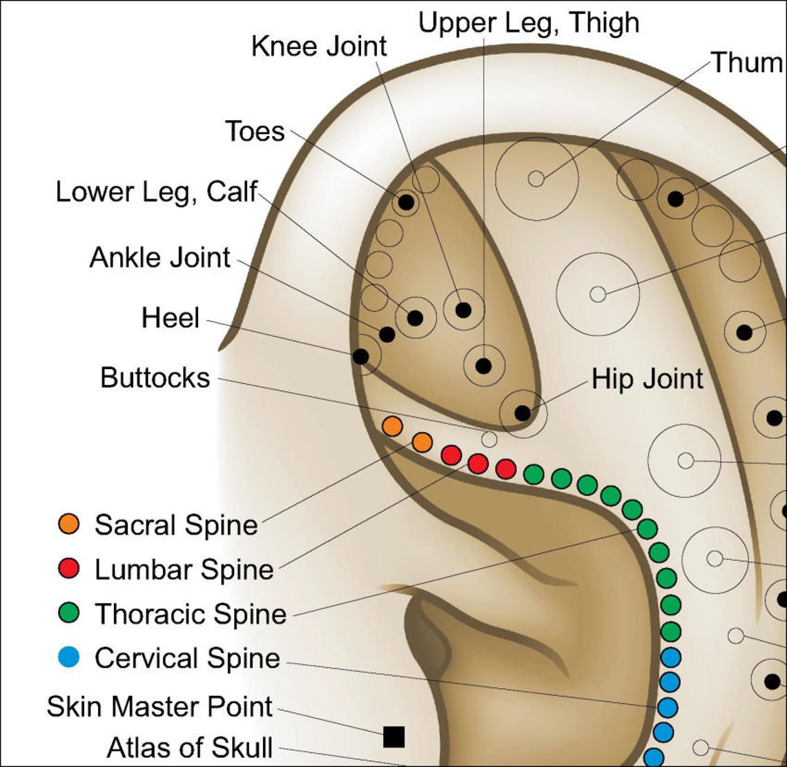 Auriculothérapie Ear Acupuncture European System Poster 18 X Etsy