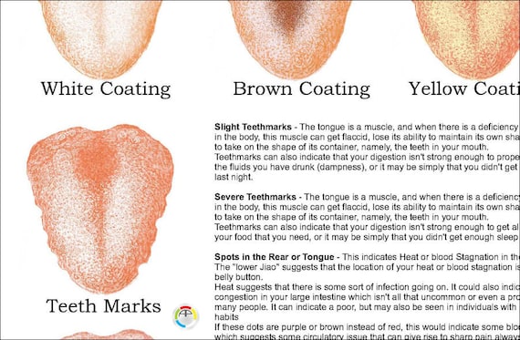 Chinese Tongue Diagnosis Chart