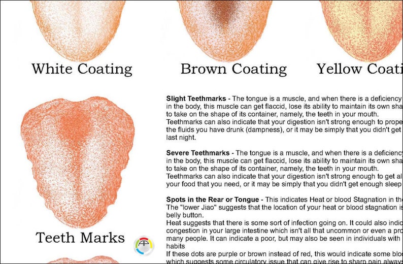 Chinese Tongue Diagnosis Poster 18 X 24 Etsy