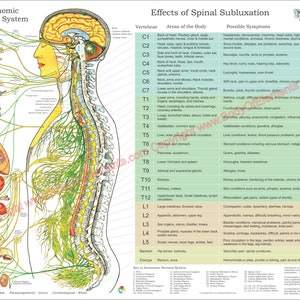 ANS & Effects of Spinal Subluxation Poster 18 X 24 Chiropractic Autonomic Nervous System Chart English, Spanish, French Laminated or Paper English