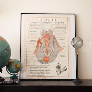 Puede incluir: Un póster educativo vintage con marco negro, titulado "Un diente y sus estructuras de soporte". El póster presenta una ilustración detallada de un diente y sus estructuras circundantes, con etiquetas que explican las diferentes partes. El póster también incluye un pequeño anuncio de Squibb Dental Cream y Squibb Tooth Powder.