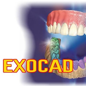 Op de afbeelding: Een 3D-weergave van tandbogen, met de tekst "EXOCAD" in een vet, geel en rood lettertype. De bovenste boog toont tanden met roze tandvlees, terwijl de onderste boog veelkleurig is. De achtergrond is een blauwe gradiënt.