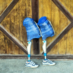 pair of german womens early 2000s prosthetic leg double above knee leg amputee