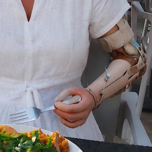 May include: A person wearing a white dress with a prosthetic arm holding a fork. The prosthetic arm is beige and brown with metal components. A plate of food is in the foreground.