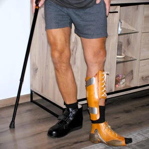 Puede incluir: Una persona con una camiseta y pantalones cortos grises, con un bast&oacute;n negro. La persona tiene una pierna prot&eacute;sica con una abrazadera marr&oacute;n y plateada y un zapato negro. La otra pierna tiene un zapato negro.