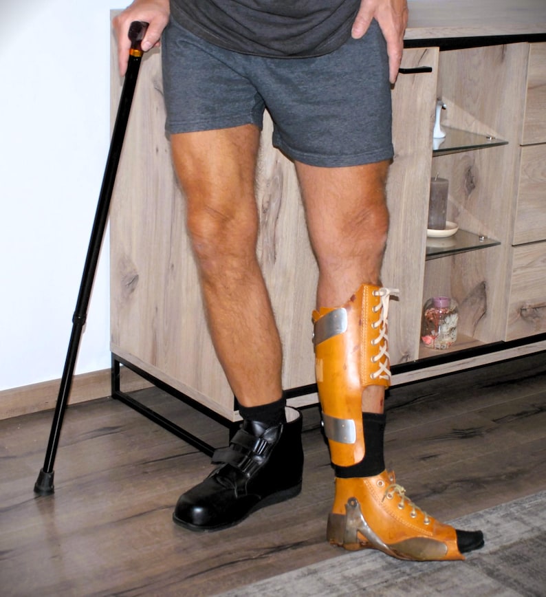 Puede incluir: Una persona con una camiseta y pantalones cortos grises, con un bast&oacute;n negro. La persona tiene una pierna prot&eacute;sica con una abrazadera marr&oacute;n y plateada y un zapato negro. La otra pierna tiene un zapato negro.