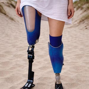 sällsynt par kvinnliga protesben, dubbelbensamputerad höger ovanför knät, vänster under knät amputation