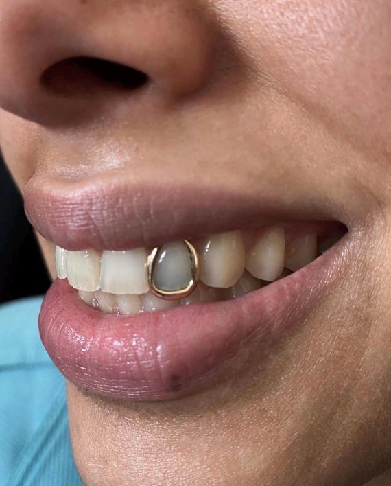 Custom Fitted Gold Or Silver Single Open Face Window Tooth Grillz