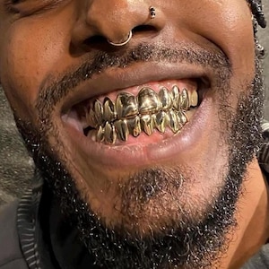 Custom Fitted Full Set Grillz – 6/8/10 Teeth Top & Bottom Slugz | Dental Gold, Silver