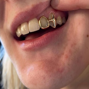 Custom Fitted Gold Or Silver Star Grillz