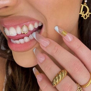 Grelha dentária personalizada em ouro ou prata com uma única janela aberta.