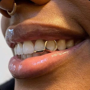 Custom Fitted Gold | Silver Window Or Heart Inlay Tip Grillz