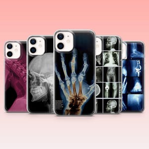 Röntgentelefonskal Medicinskt Skelett för iPhone 17Pro 16, 15, 14, 13, 12, Samsung S25, S24, S23Fe, S22, A16, A26, A56, Pixel 10, 9Pro
