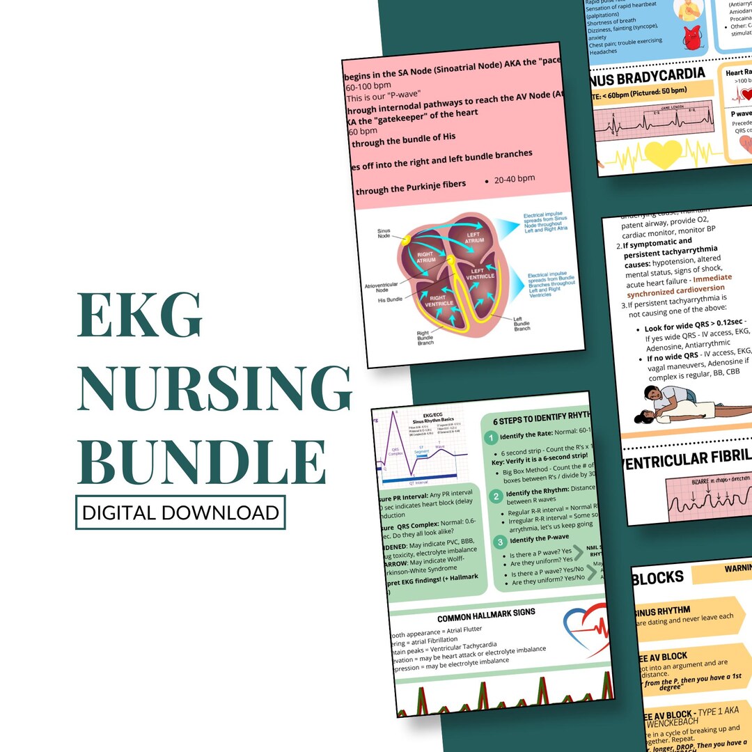 EKG Nursing Bundle | Nurse Study Note Guide | 8-page NCLEX Prep Sheet ...