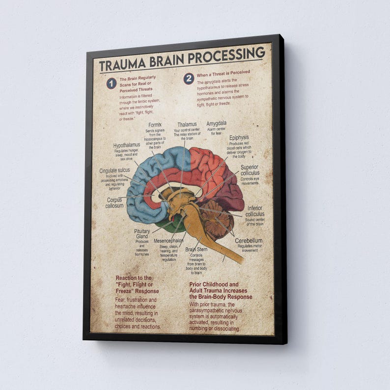 Trauma Brain Processing Poster or Canvas, Brain Anatomy Wall Art ...