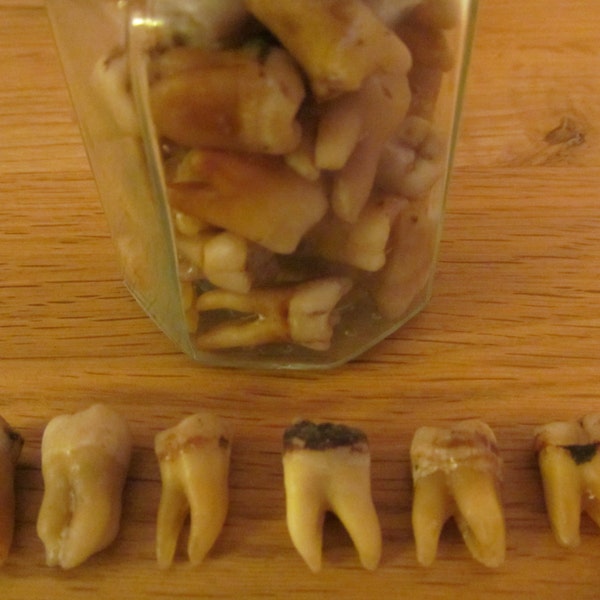 Human teeth maxillary molar back teeth with roots nice old teeth x 3