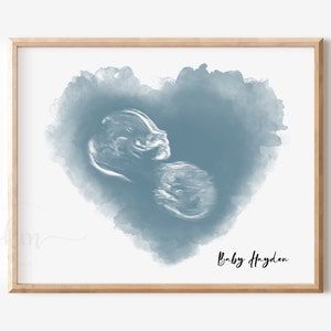 Baby Ultraschall Kunst, Aquarell Herz, Benutzerdefinierte Neugeborenen Andenken, Sonogramm Druck, personalisierte Dusche Geschenk, Sonographie, neue Mama Kinderzimmer Dekor