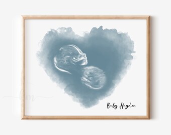 Baby Ultrasound Art, Watercolor Heart, Custom Newborn Keepsake, Sonogram Print, Personalized Shower Gift, Sonography, New Mom Nursery Decor