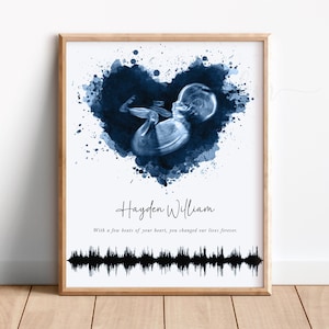 Arte de ondas sonoras de latidos del corazón de bebé con ultrasonido, recuerdo de bebé personalizado, impresión de ecografía de acuarela con corazón, regalos personalizados para baby shower, ondas sonoras