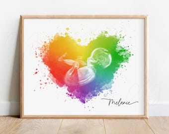 Regenbogen-Baby-Ultraschallkunst, Vatertagsgeschenk, Herz-Aquarell-Sonogrammdruck, gemaltes benutzerdefiniertes Duschgeschenk, personalisierte Sonographiekunst