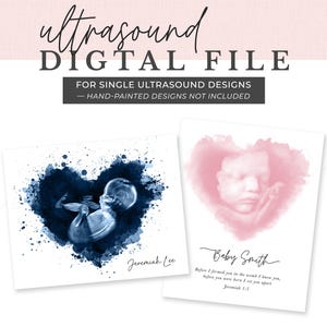 Ultraschall DIGITALE DATEI - Einzelbild-Designs! Benutzerdefinierte Baby Sonogramm Kunst, Aquarell Sonographie Druck, personalisiertes Duschgeschenk, neue Mutter