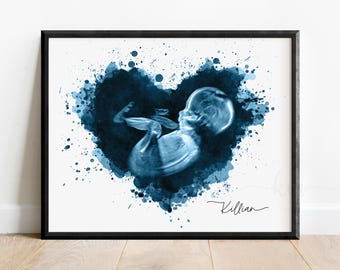 Baby Ultrasound Art Print, Watercolor Heart, Baby Keepsake, Baby Sonogram, New Mom Gift, Personalized Baby Shower Gift, Gender Reveal