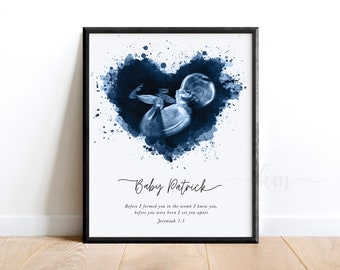 Baby Ultrasound Art Print, Newborn Keepsake Art, Sonogram Watercolor Heart, Personalized Baby Shower Gift, New Mom Nursery Decor Sonography