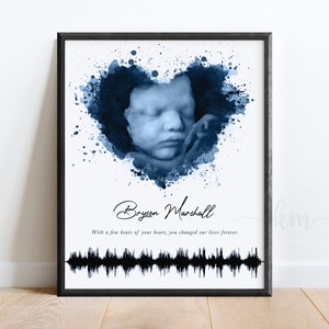 Watercolor Ultrasound Art with Baby&#39;s Heartbeat, Soundwave Art, Custom Baby Keepsake, Personalized Baby Shower Gift, Sound Wave New Mom Gift