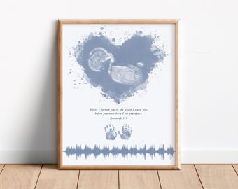 Custom Baby Loss Gift, Watercolor Ultrasound Art, Pregnancy Loss Gift, Memorial Gift, Stillborn Bereavement Gift, Baby Handprints Heartbeat