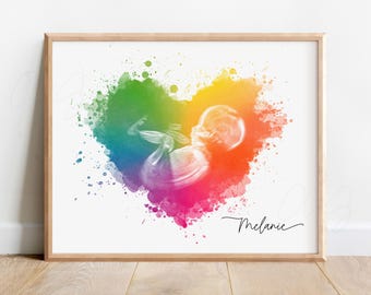 Regenbogen Baby Ultraschall Kunst, Herz Sonogramm Druck, personalisierte Dusche Geschenke, benutzerdefinierte Sonographie Kunst, Regenbogen Schwangerschaft Geschenk, Fehlgeburt TTC