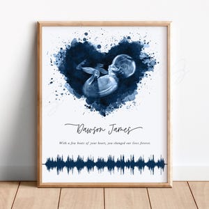 May include: A framed print featuring a watercolor heart in shades of blue, with a fetal ultrasound image at its center. The name "Dawson James" is written below, along with a quote and a soundwave graphic.