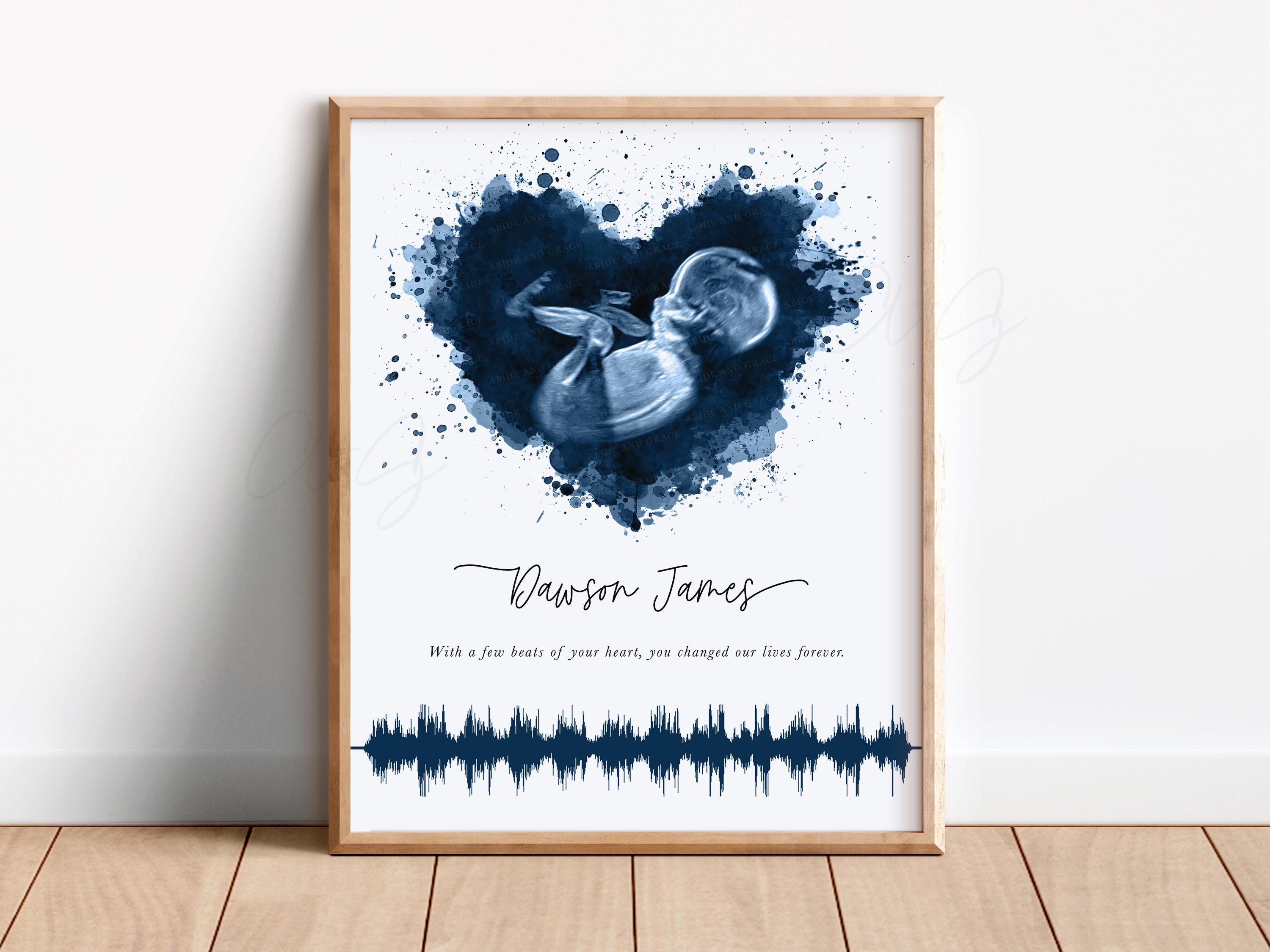 Ultrasound Baby Heartbeat Soundwave Art, Custom Baby Keepsake