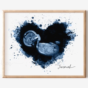 Baby Ultrasound Art Print, Watercolor Heart, Baby Keepsake, Baby Sonogram, New Mom Gift, Personalized Baby Shower Gift, Gender Reveal