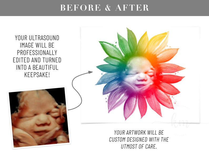 Pu&ograve; includere: Un'immagine prima e dopo che mostra un'immagine di ecografia 3D del viso di un bambino trasformata in un girasole acquerellato colorato. Il testo recita "La tua immagine di ecografia sar&agrave; elaborata professionalmente e trasformata in un bellissimo ricordo!" e "La tua opera d'arte sar&agrave; progettata su misura con la massima cura."