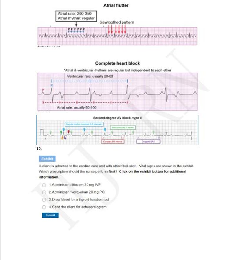 Flutter With Rvr Rate 160s Example ECG EKG Practice Test, Nursing Medical Staff Study Guide (PDF) - Etsy