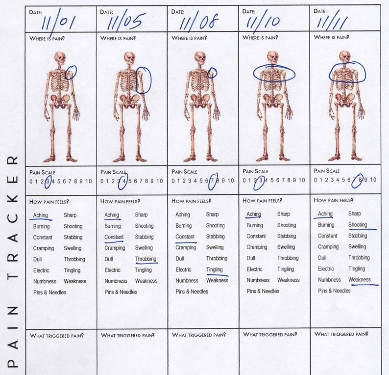 Printable Pain Tracker With 1916 Vintage Skeleton - 4 Layouts, Double ...