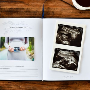 Dear Baby: A Pregnancy Prayer Journal & Memory Book for Expecting Moms by Duncan & Stone | Pregnancy Keepsake | Scrapbook Album for Milestones | Baby Announcement | New Mom to Be Gift