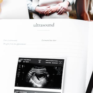 May include: A white journal with the word "ultrasound" printed on the cover. The journal has a section for recording the date of the ultrasound, estimated due date, and thoughts from the appointment. A black and white ultrasound image is visible on the page.