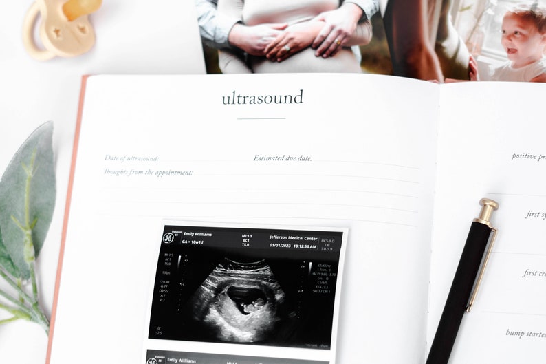 May include: A white journal with the word "ultrasound" printed on the cover. The journal has a section for recording the date of the ultrasound, estimated due date, and thoughts from the appointment. A black and white ultrasound image is visible on the page.