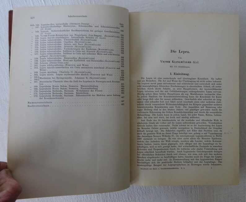 vintage medical book, The Leprosy, Die Lepra, German language, leather bound, 1930, rare, illustrated, from Diz Has Neat Stuff image 6