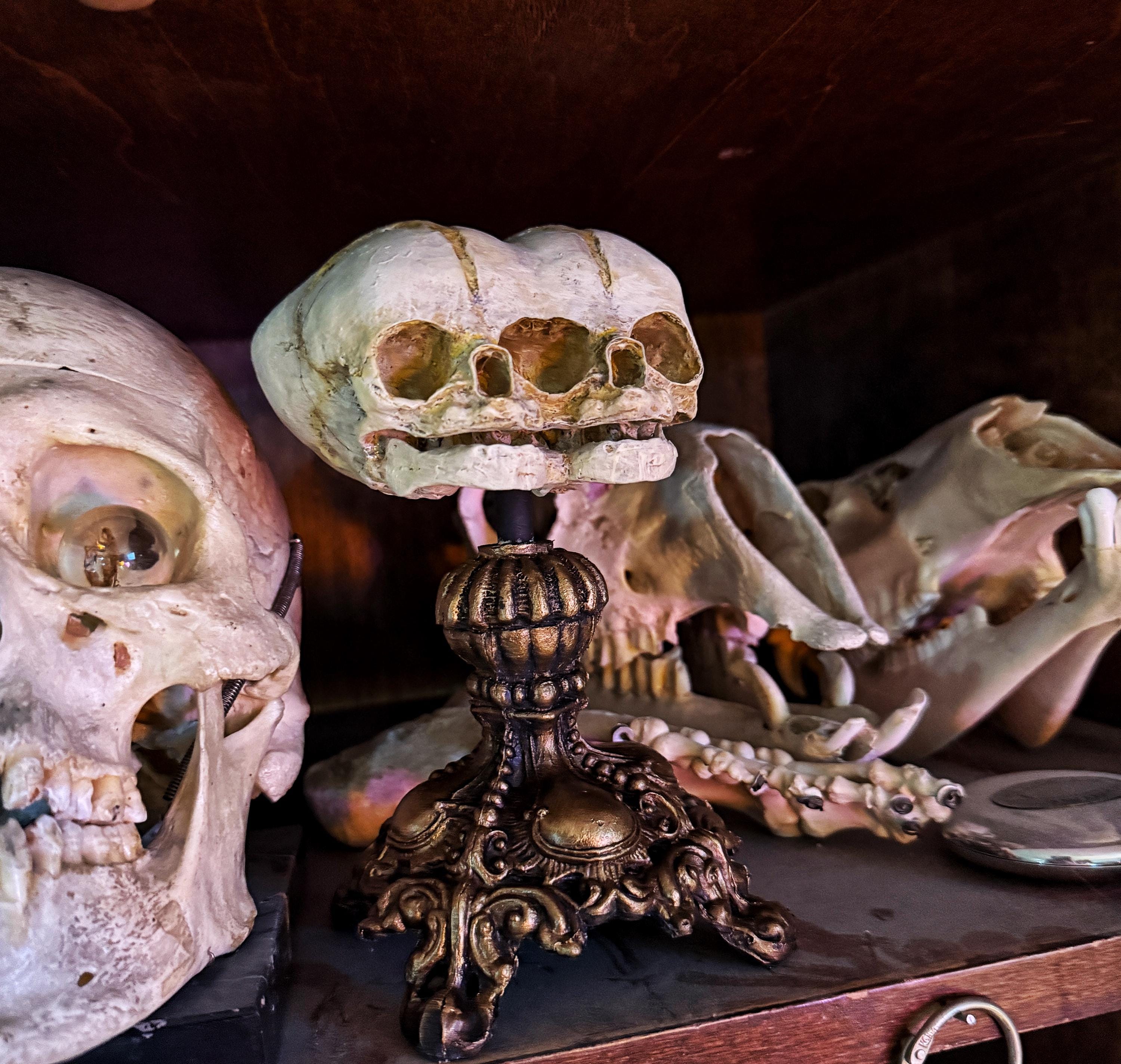 Conjoined Twins Fetal Skull Display – Gothic Anatomical Art