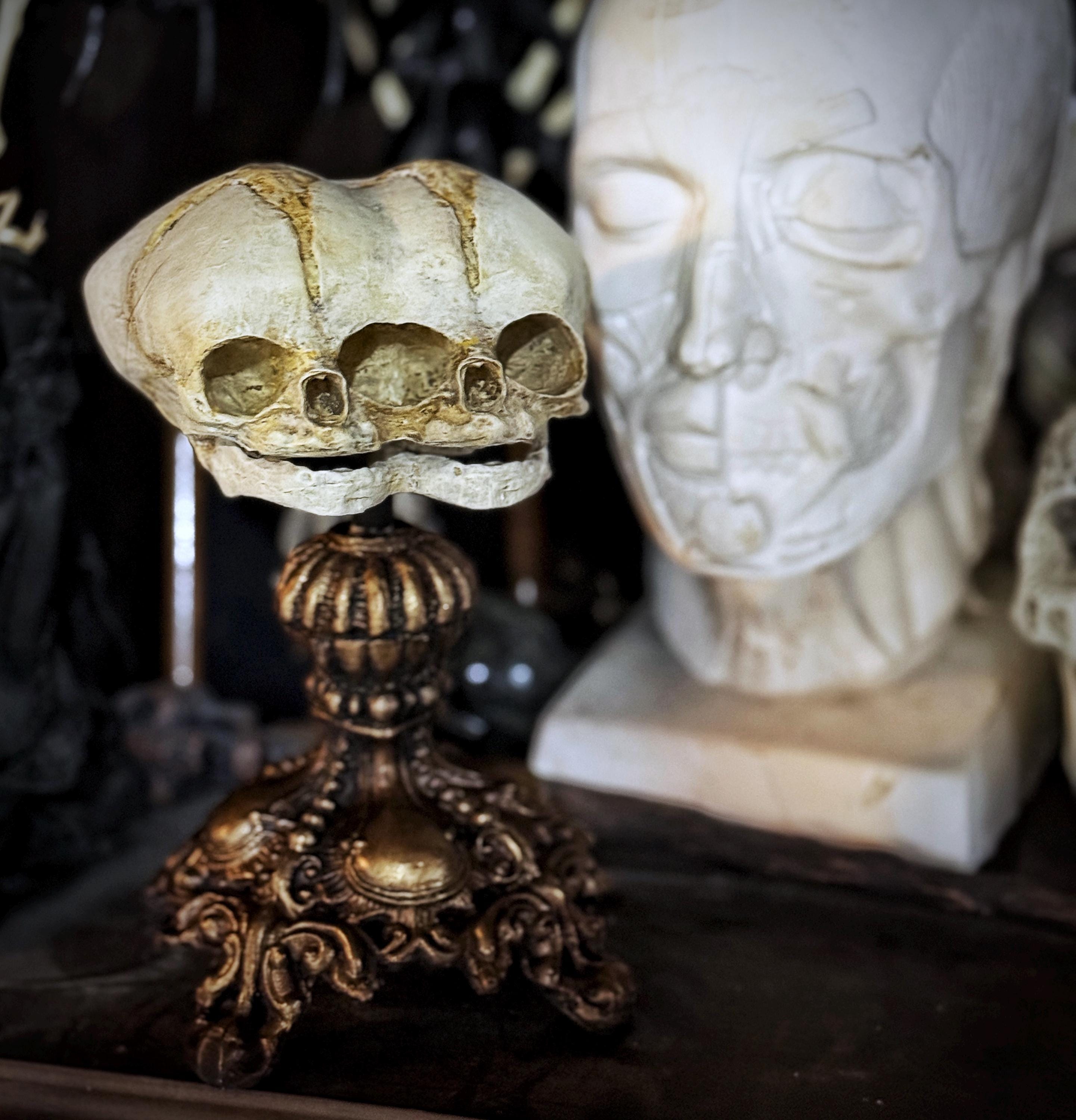 Conjoined Twins Fetal Skull Display – Gothic Anatomical Art