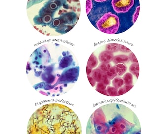 Public Health Poster: STDS