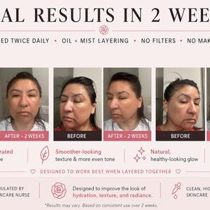 Puede incluir: Un gr&aacute;fico comparativo de cuidado de la piel titulado REAL RESULTS IN 2 WEEKS. Muestra tres conjuntos de fotos de antes y despu&eacute;s del rostro de una persona, destacando la textura y el tono de la piel. El texto incluye USED TWICE DAILY, NO FILTERS, NO MAKEUP.