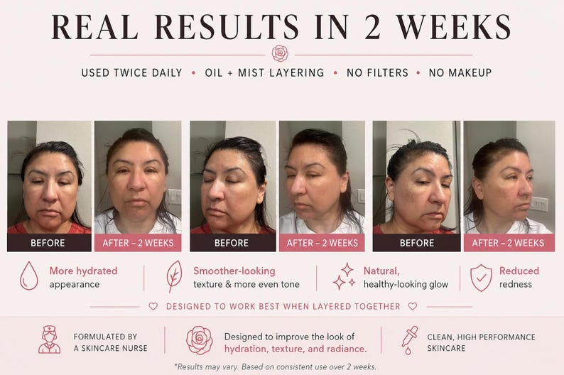Puede incluir: Un gr&aacute;fico comparativo de cuidado de la piel titulado REAL RESULTS IN 2 WEEKS. Muestra tres conjuntos de fotos de antes y despu&eacute;s del rostro de una persona, destacando la textura y el tono de la piel. El texto incluye USED TWICE DAILY, NO FILTERS, NO MAKEUP.