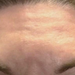 Peut inclure: Gros plan sur le front et les sourcils d'une personne. La peau est claire avec des rides visibles sur le front. Les sourcils sont fonc&eacute;s et bien d&eacute;finis.