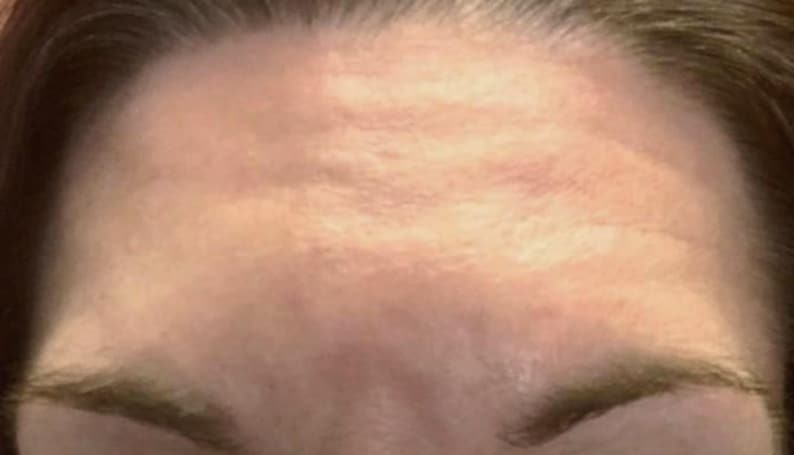 Peut inclure: Gros plan sur le front et les sourcils d'une personne. La peau est claire avec des rides visibles sur le front. Les sourcils sont fonc&eacute;s et bien d&eacute;finis.